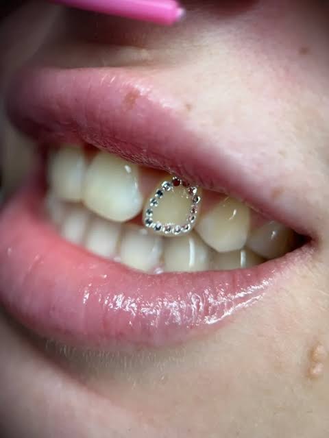 Tooth Gems